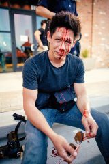 Advocate Photo Editor Danny Fulgencio after being struck by a rock at a Trump Rally. Photo by Kathy Tran