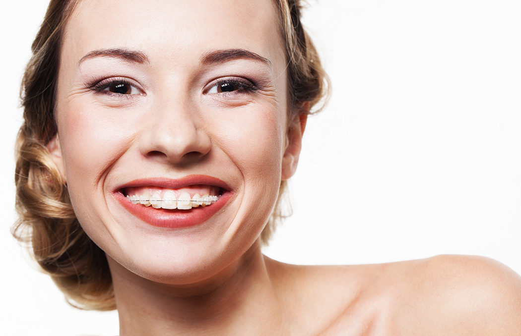 Smile with dental braces Getty Image