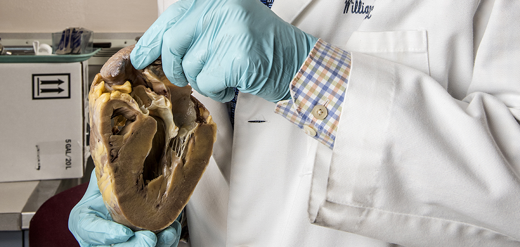 Dr. William Roberts holds a heart. (Photo by Danny Fulgencio)